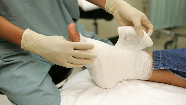 how to treat sprained ankle - compression