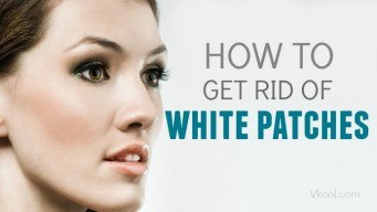 how to get rid of white patches