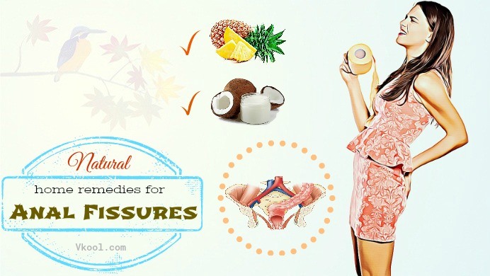 home remedies for anal fissures