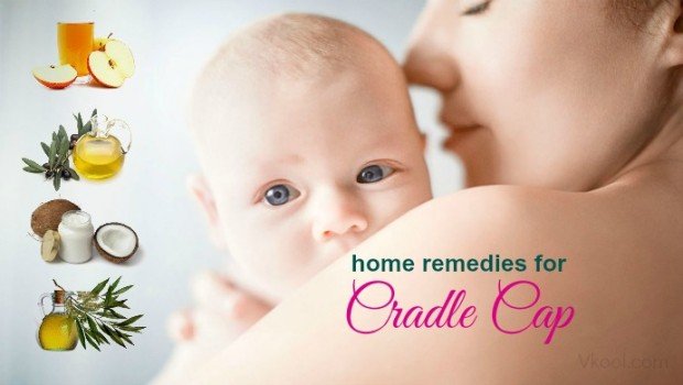 home remedies for cradle cap in babies