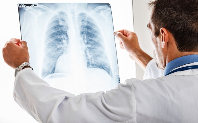 shortness of breath causes - pulmonary embolism