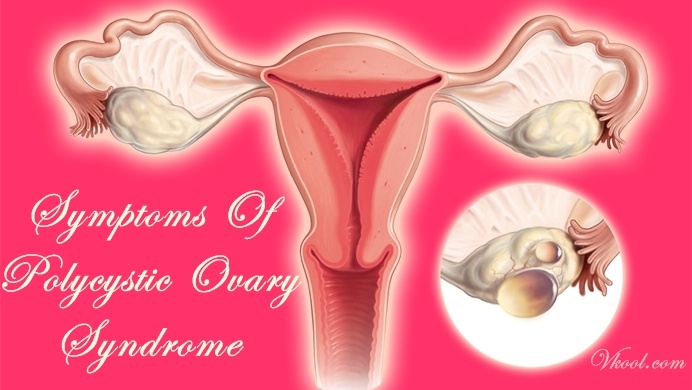 early symptoms of polycystic ovary syndrome