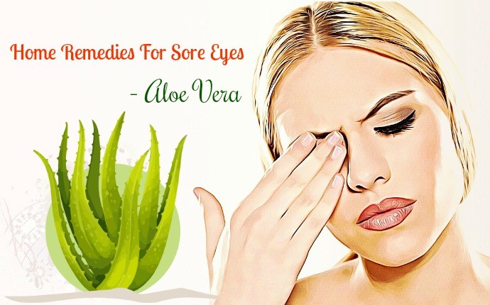 home remedies for sore eyes - aloe vera 