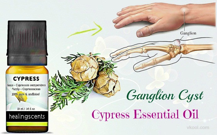 how to treat a ganglion cyst - cypress essential oil