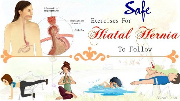best exercises for hiatal hernia