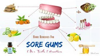 home remedies for sore gums after tooth extraction