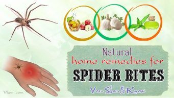 home remedies for spider bites on legs
