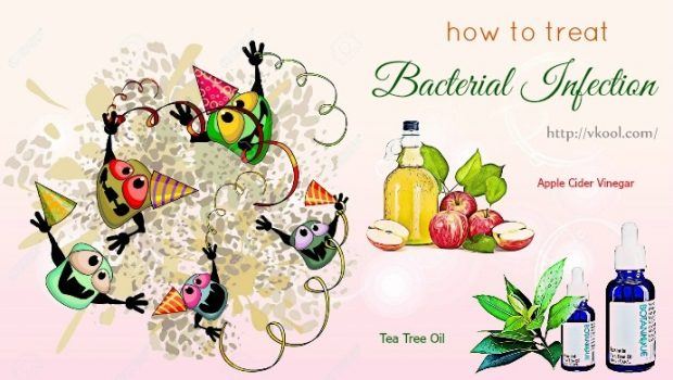 how to treat bacterial infection naturally