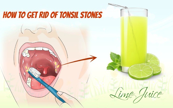 how to get rid of tonsil stones - lime juice