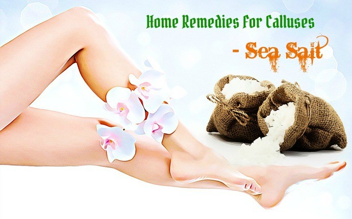 home remedies for calluses - sea salt