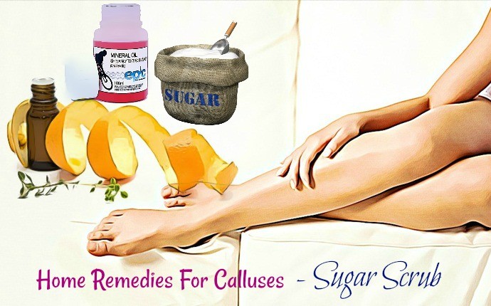 home remedies for calluses - sugar scrub