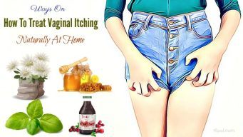 how to treat vaginal itching naturally