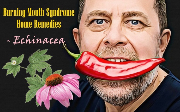 burning mouth syndrome home remedies - echinacea
