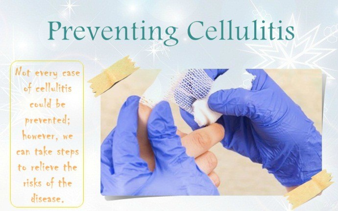 preventing cellulitis