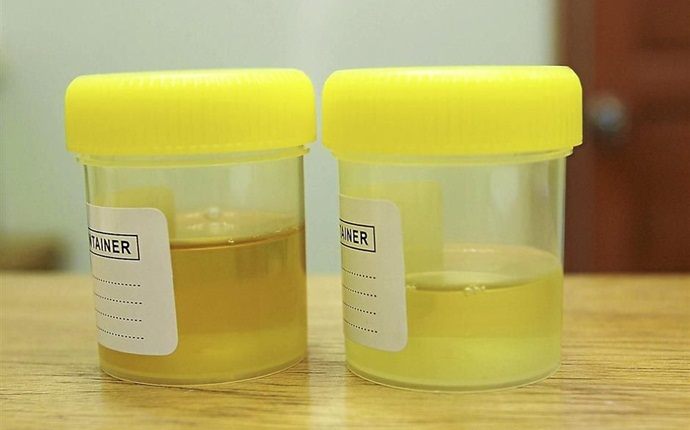pancreatic cancer symptoms - change color of urine