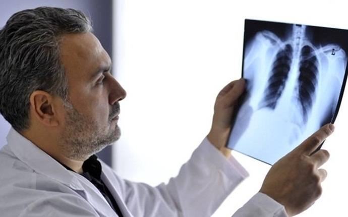 symptoms of lung cancer - frequent chest infections