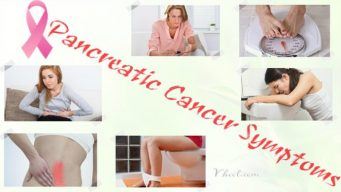 early pancreatic cancer symptoms