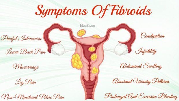 signs and symptoms of fibroids