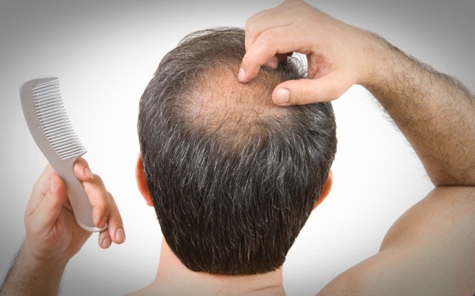 benefits of lavender oil - treat alopecia areata