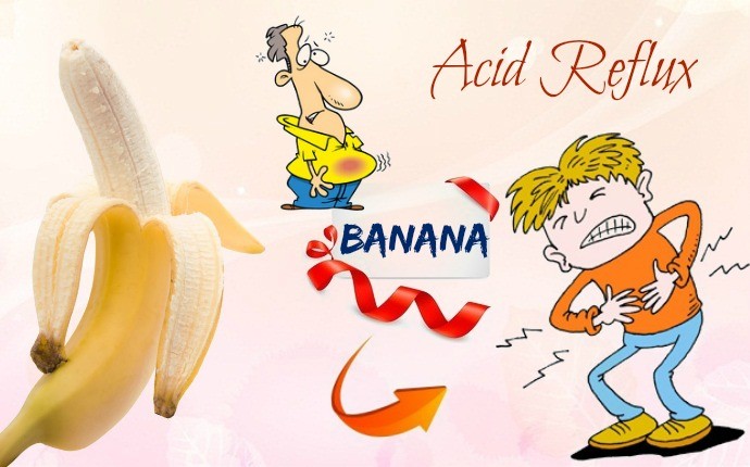 banana for acid reflux - banana for acid reflux