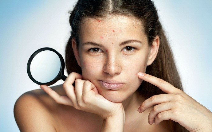 benefits of fenugreek - reduce acnes