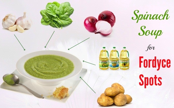 home remedies for fordyce spots - spinach soup