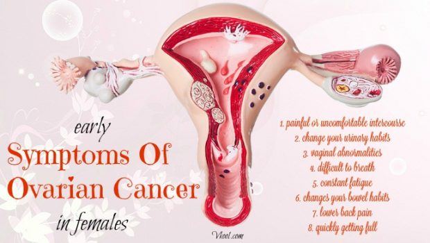 early symptoms of ovarian cancer