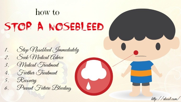 how to stop a nosebleed fast