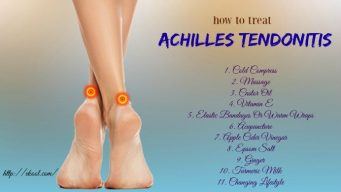 how to treat achilles tendonitis naturally