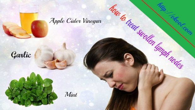 how to treat swollen lymph nodes naturally