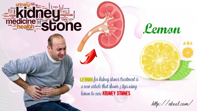 lemon for kidney stones treatment