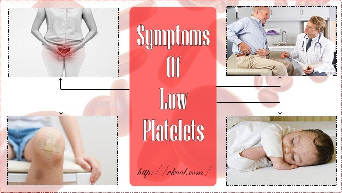 symptoms of low platelets in babies