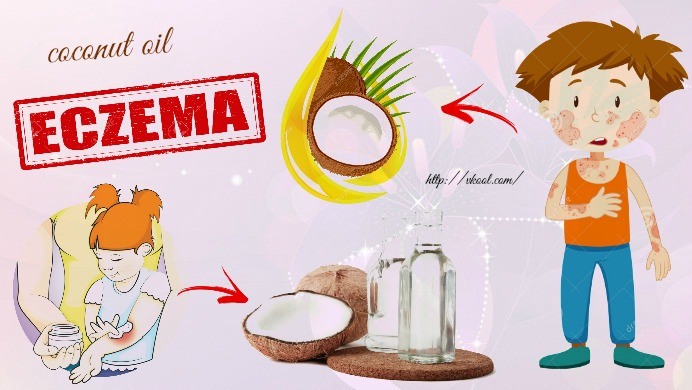 natural coconut oil for eczema