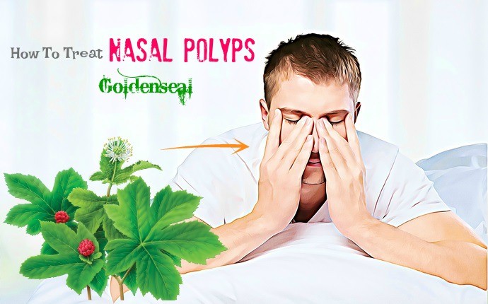 how to treat nasal polyps - goldenseal