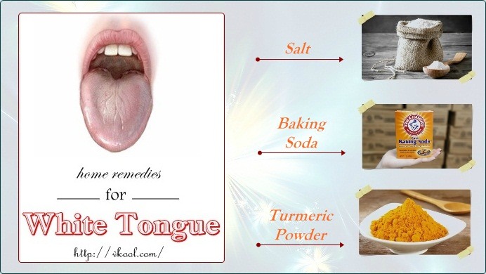 best natural home remedies for white tongue