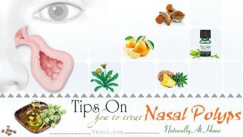 how to treat nasal polyps naturally