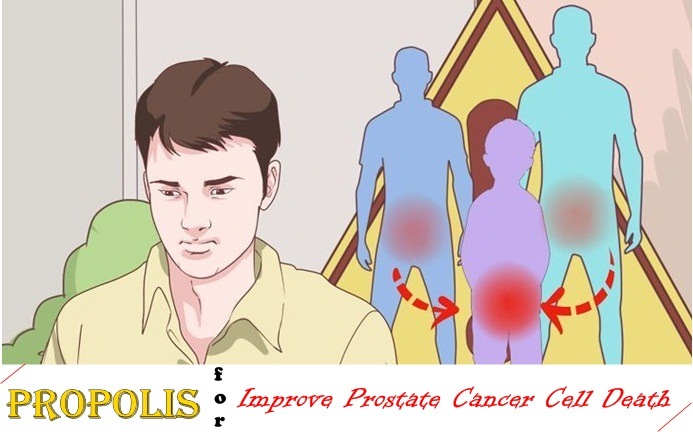 benefits of propolis - improve prostate cancer cell death
