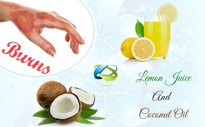 first aid for burns - lemon juice and coconut oil