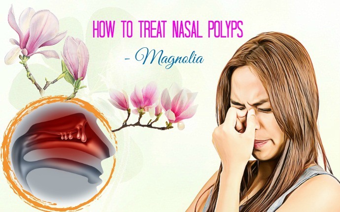 how to treat nasal polyps - magnolia