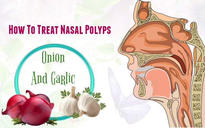 how to treat nasal polyps - onion and garlic
