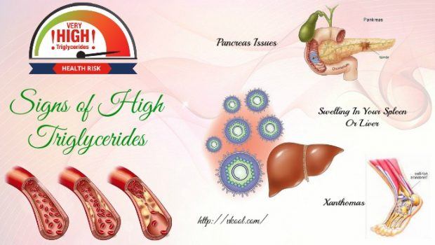 signs of high triglycerides and cholesterol