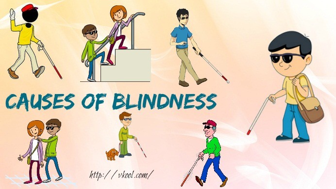 common causes of blindness