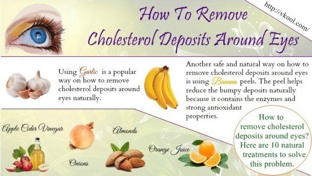 cholesterol deposits around eyes