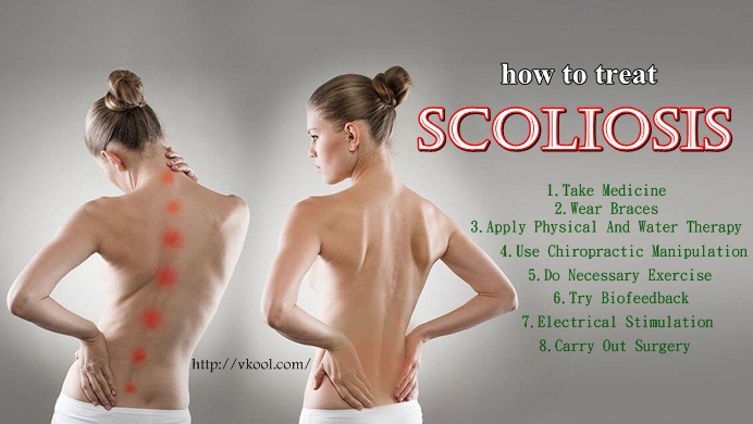 how to how to treat scoliosis naturally