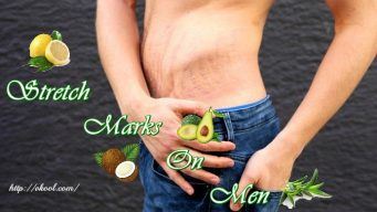 how to remove stretch marks on men