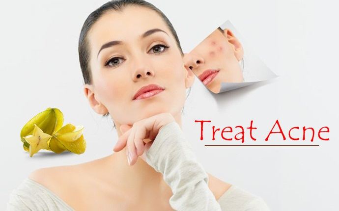 benefits of starfruit-treat acne