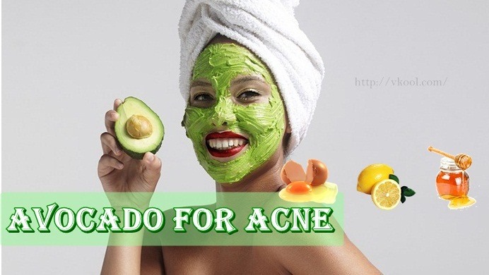 avocado for acne treatment