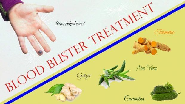 blood blister treatment