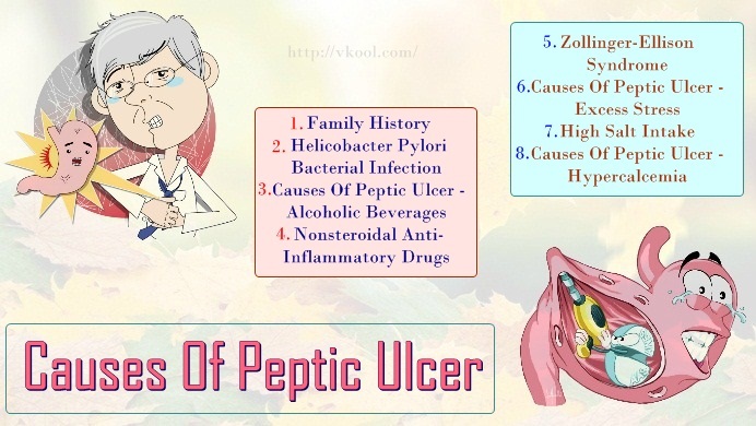 common causes of peptic ulcer