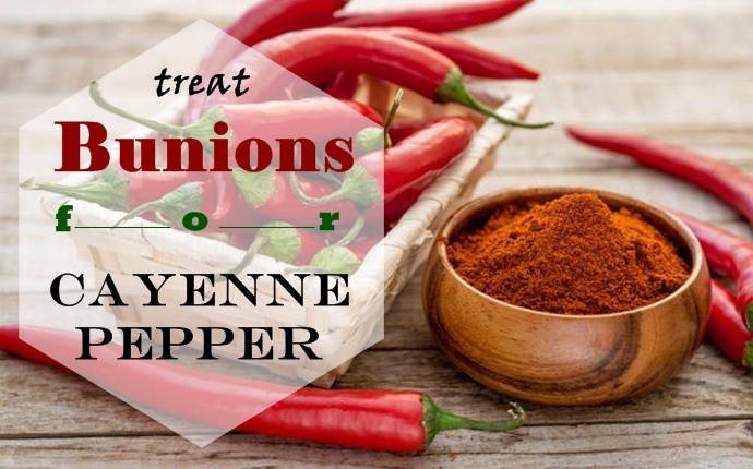 how to treat bunions - cayenne pepper